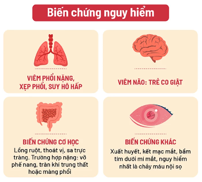 Biến chứng ho gà