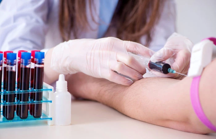 Chẩn đoán bệnh Chikungunya