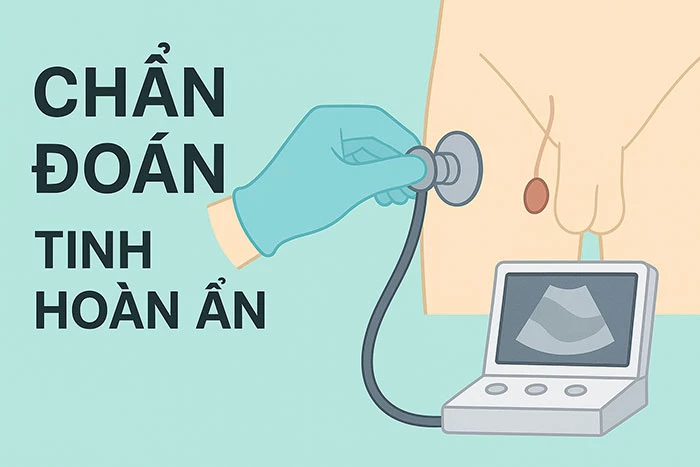 Chẩn đoán tinh hoàn ẩn