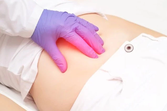 Chẩn đoán viêm phúc mạc