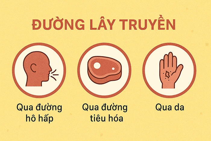 Nguyên nhân gây bệnh than