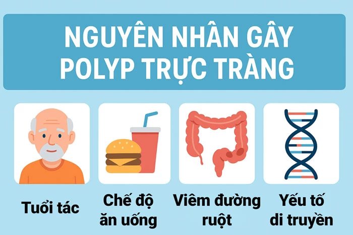 Nguyên nhân gây polyp trực tràng