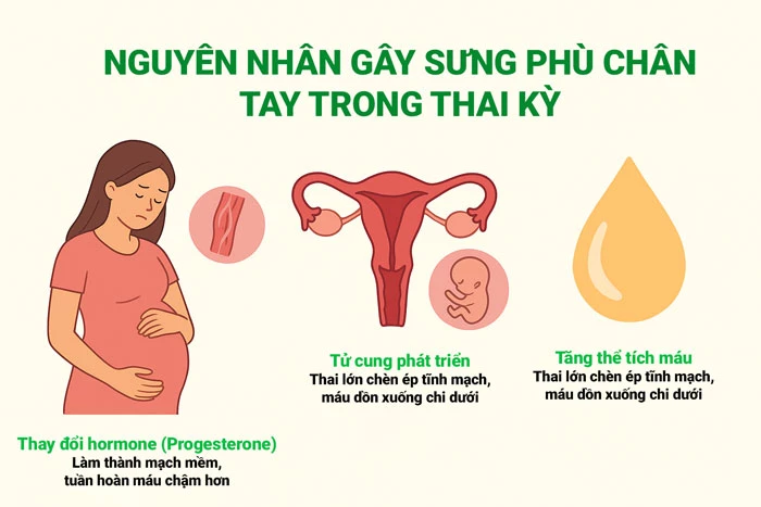 Nguyên nhân gây sưng phù chân tay trong thai kỳ