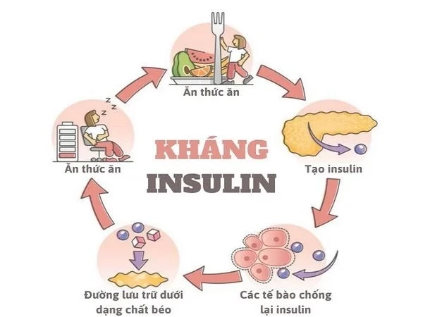 Nguyên nhân gây rối loạn dung nạp glucose