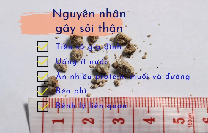 Nguyên nhân gây ra sỏi thận