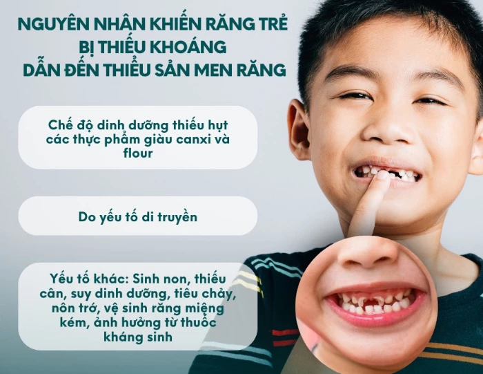 Nguyên nhân gây thiểu sản men răng