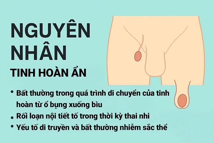 Nguyên nhân gây tinh hoàn ẩn