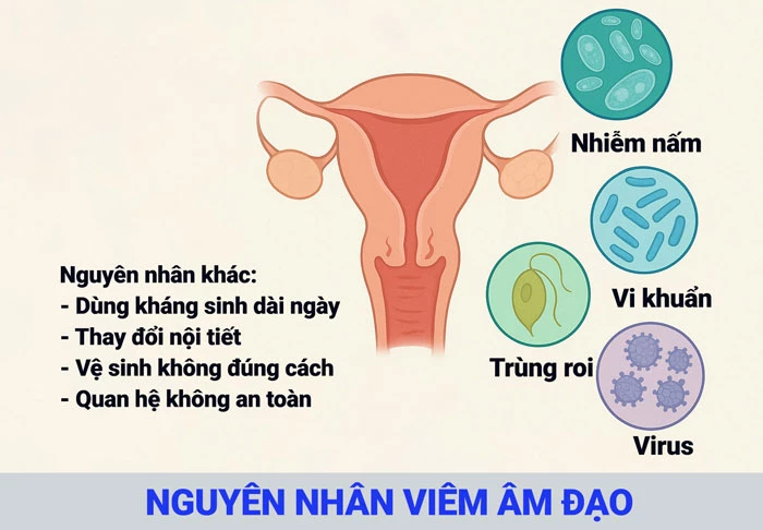 Nguyên nhân viêm âm đạo