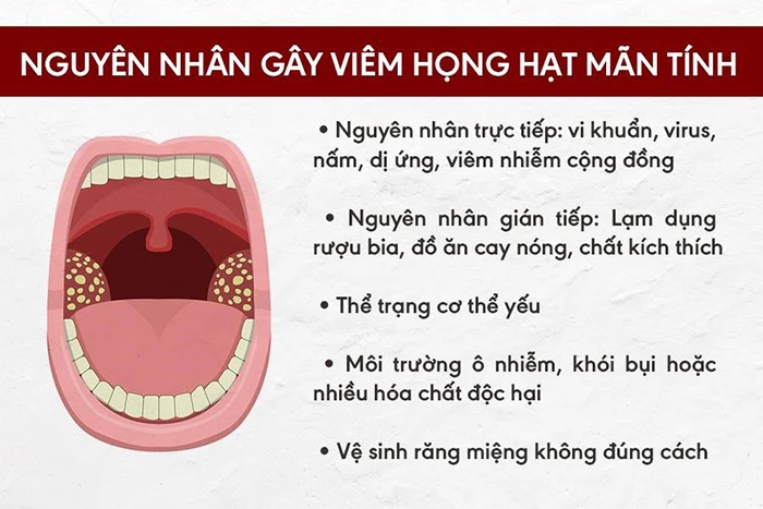 Nguyên nhân gây viêm họng hạt