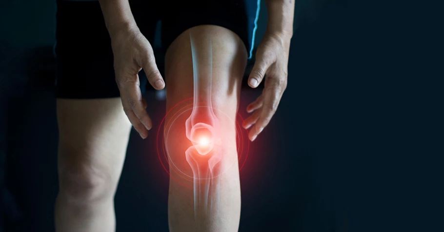 Thoái Hóa Khớp Gối: Nguyên Nhân, Triệu Chứng & Cách Điều Trị