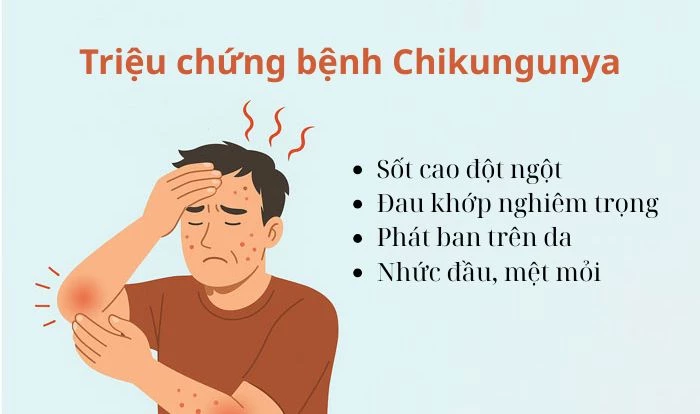 Triệu chứng của bệnh Chikungunya
