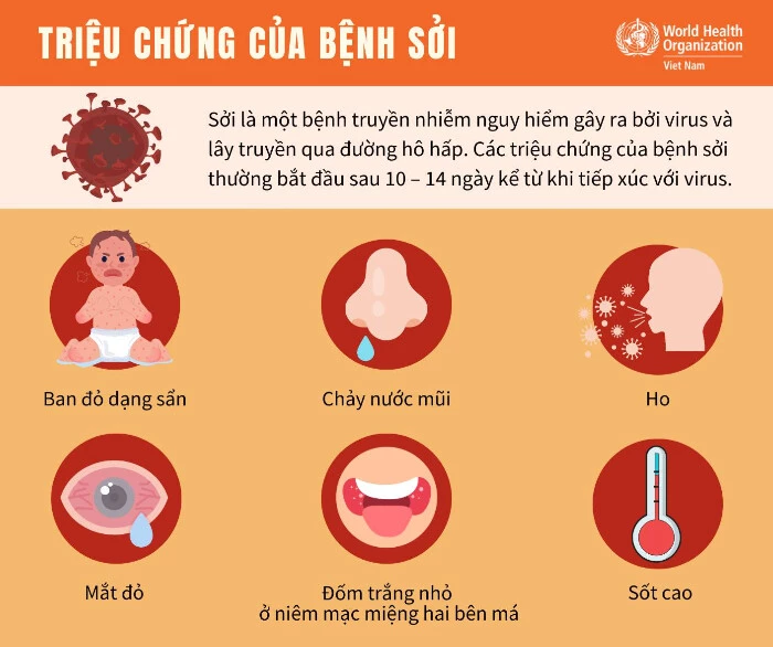 Dấu hiệu, triệu chứng của bệnh sởi