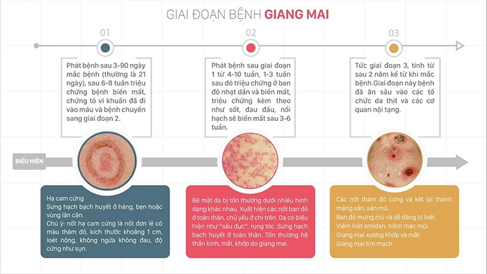 Triệu chứng của bệnh giang mai