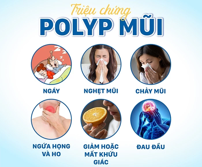 Triệu chứng Polyp mũi