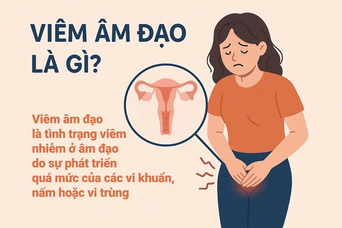 Viêm âm đạo là gì