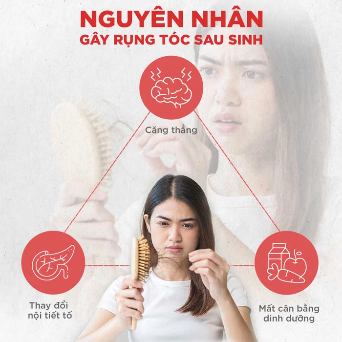 Nguyên nhân gây rụng tóc sau sinh