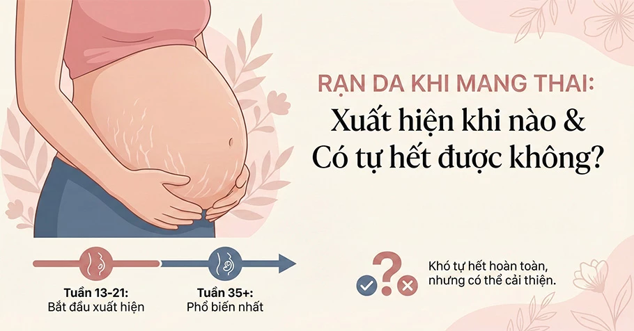 Rạn da khi mang thai: Xuất hiện khi nào & Có tự hết được không?