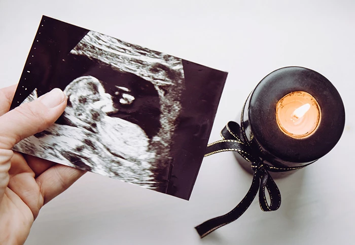 Sảy thai liên tiếp là gì? Khi nào cần đi khám chuyên sâu