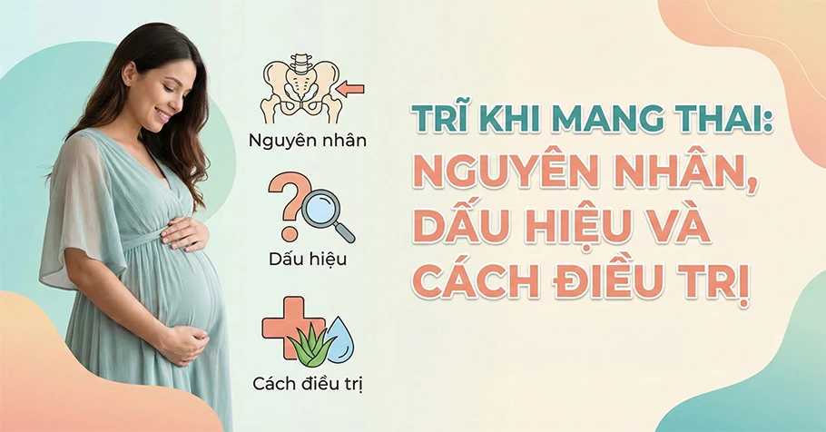 Trĩ khi mang thai: Nguyên nhân, dấu hiệu và cách điều trị