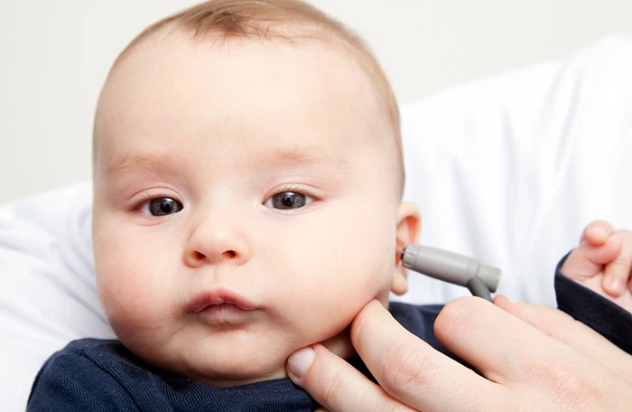 Lạm dụng núm ti giả cho trẻ sơ sinh làm tăng nguy cơ mắc bệnh viêm tai giữa ở trẻ.